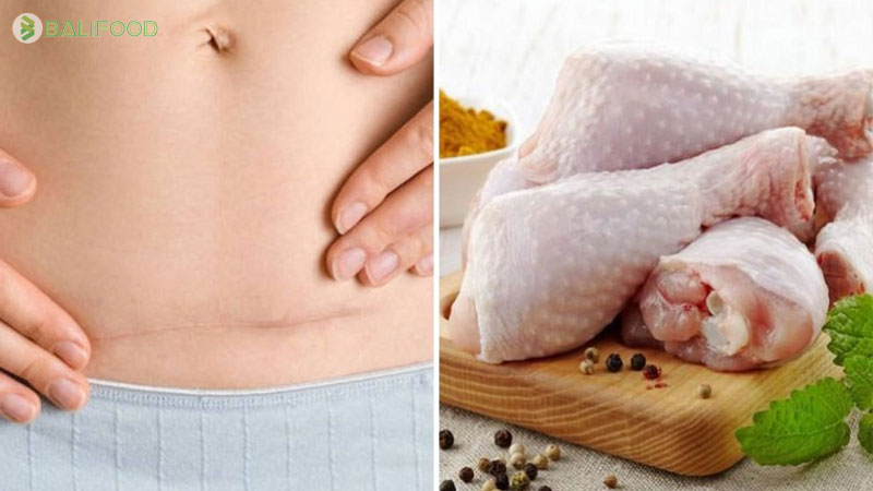 Phụ nữ đẻ mổ có ăn được thịt gà không?
