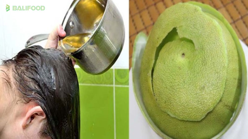 Nguyên nhân rụng tóc sau sinh và cách chữa trị hiệu quả nhanh nhất